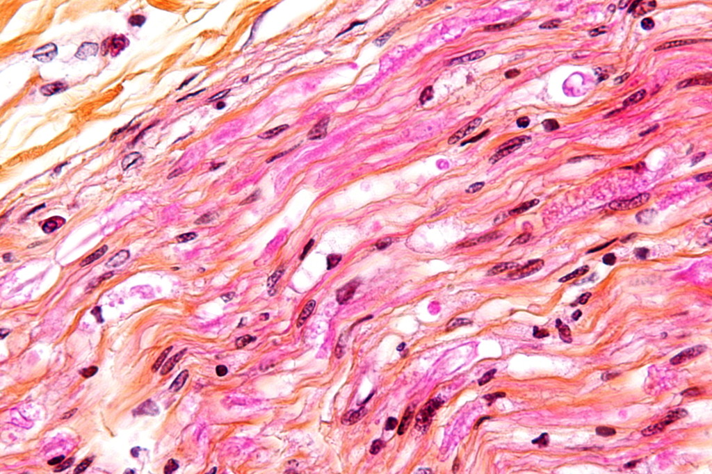 Digestion_chambers_--_very_high_mag_-_cropped