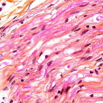 Digestion_chambers_--_very_high_mag_-_cropped