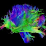 HCP_Tracts-2-b-720x582